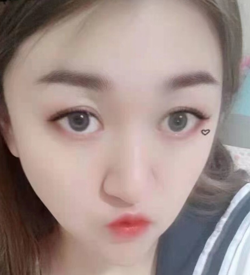 哈市小美
